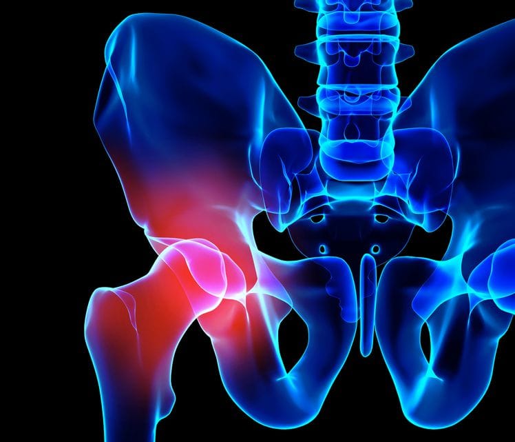 Why You Should Be Familiar With The Sacro-iliac Joint